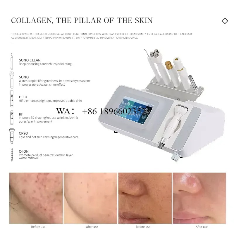 WMWMNU for Desktop Facial Lift - Home Improvement Us review and price